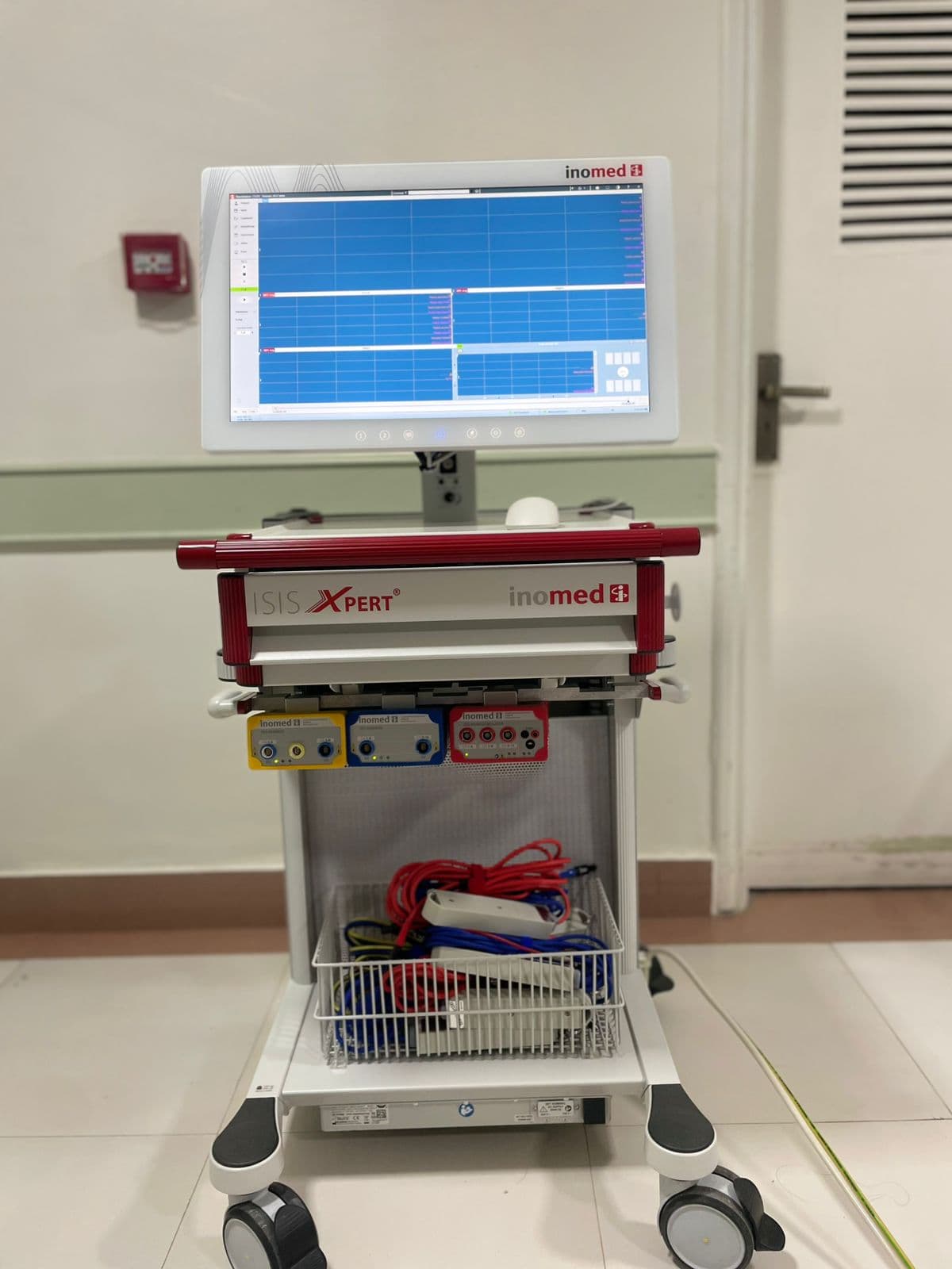 Intra-Operative Neuro Monitoring Research