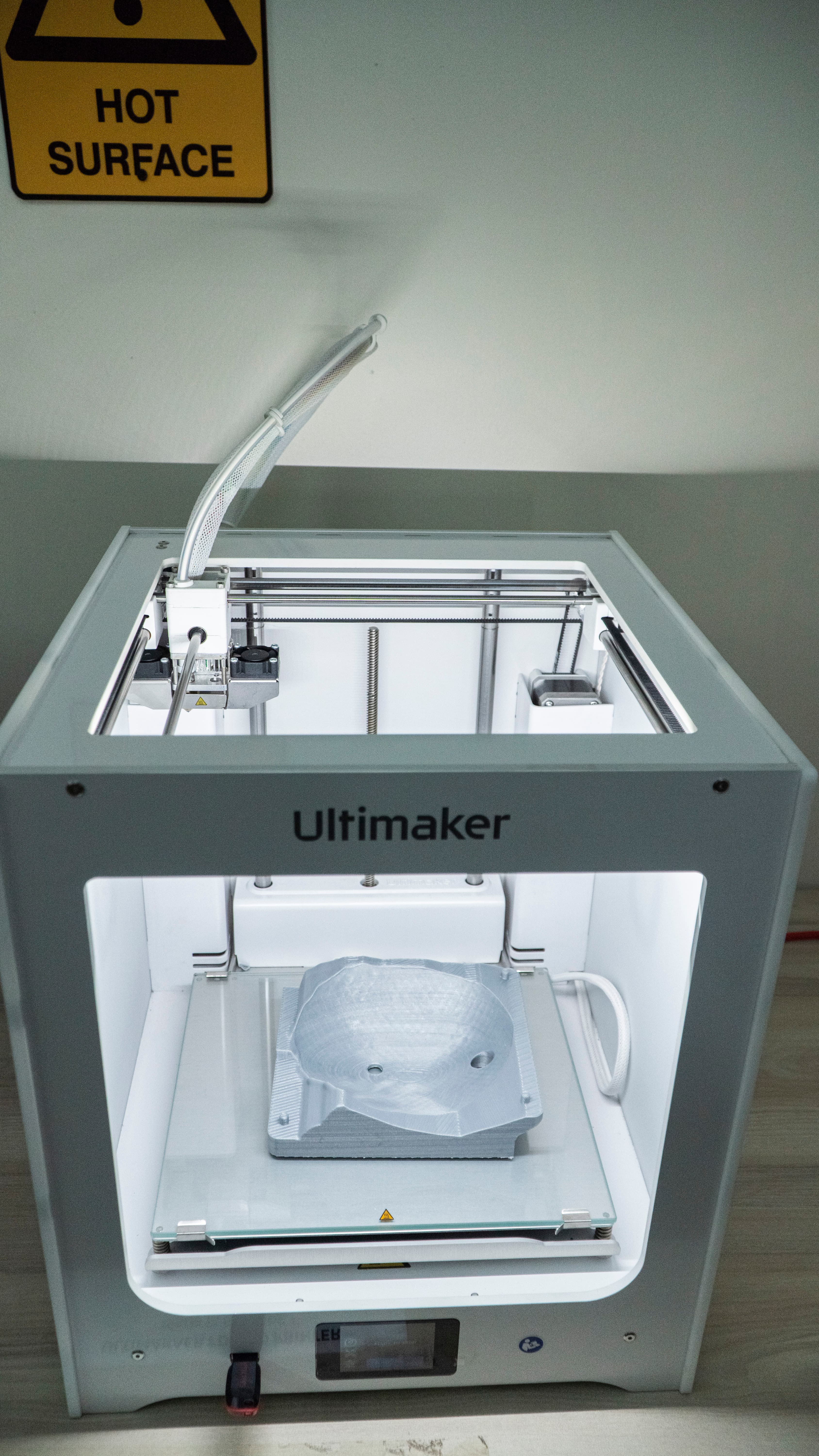 3D Printing for Surgical Planning